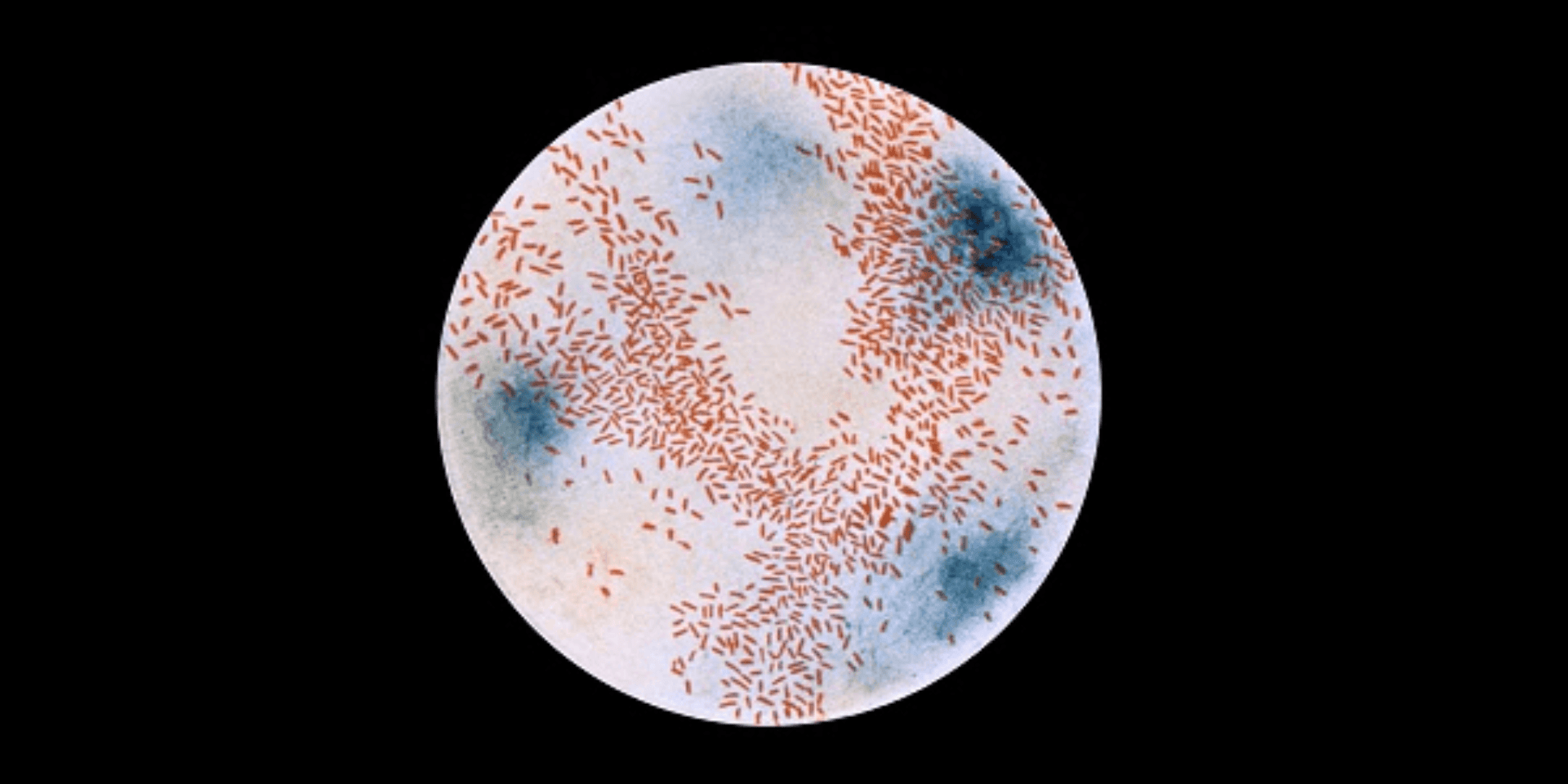 Hib Virus_Featured Image Hib Virus